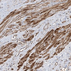 LATS1 Antibody, Novus Biologicals 0.1mL; Unlabeled:Antibodies, Polyclonal